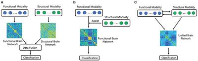 Multimodal Brain Network Jointly Construction and Fusion for Diagnosis of Epilepsy